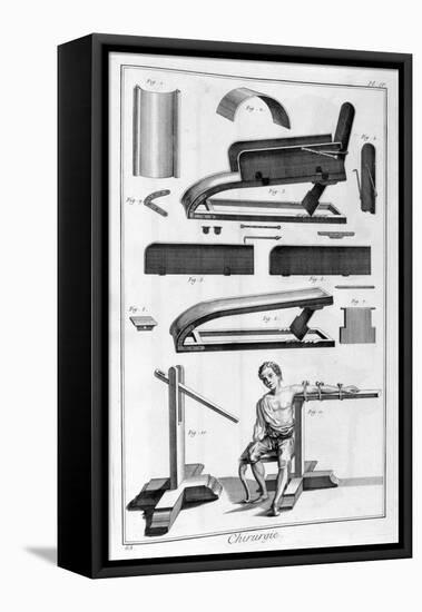 Surgery, 1751-1777-Denis Diderot-Framed Premier Image Canvas
