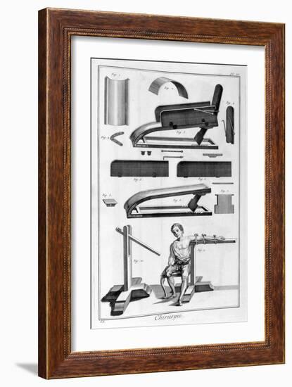 Surgery, 1751-1777-Denis Diderot-Framed Giclee Print