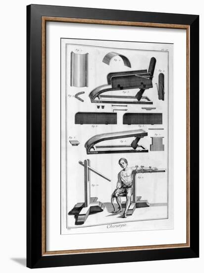 Surgery, 1751-1777-Denis Diderot-Framed Giclee Print