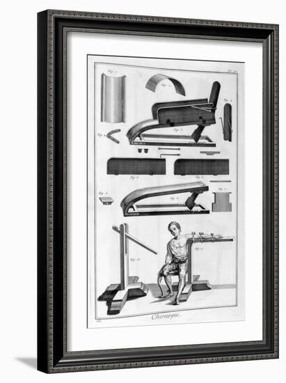 Surgery, 1751-1777-Denis Diderot-Framed Giclee Print