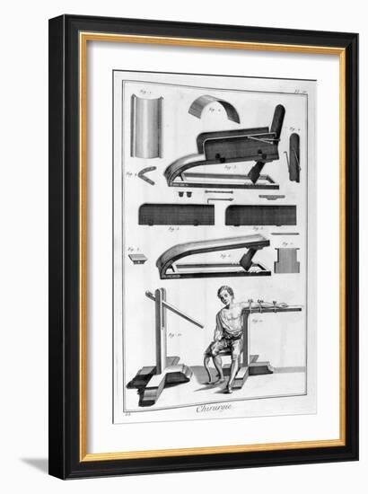 Surgery, 1751-1777-Denis Diderot-Framed Giclee Print