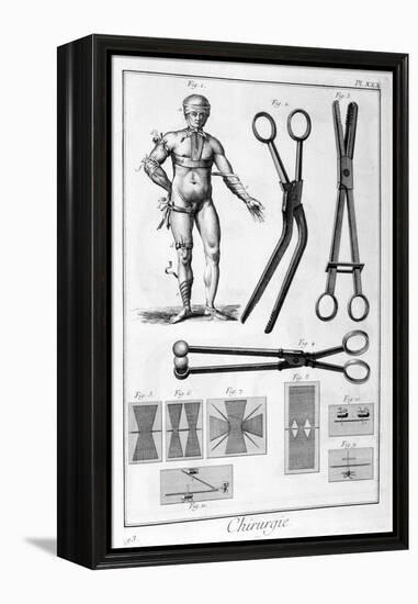 Surgery, 1751-1777-Denis Diderot-Framed Premier Image Canvas