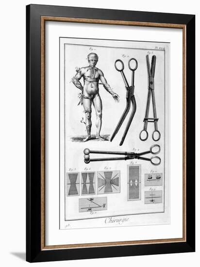 Surgery, 1751-1777-Denis Diderot-Framed Giclee Print