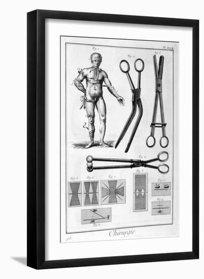 Surgery, 1751-1777-Denis Diderot-Framed Giclee Print