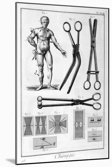 Surgery, 1751-1777-Denis Diderot-Mounted Giclee Print