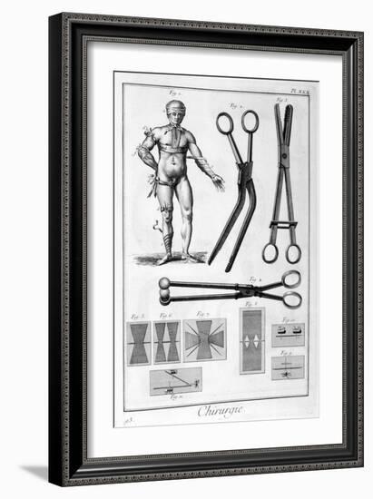 Surgery, 1751-1777-Denis Diderot-Framed Giclee Print