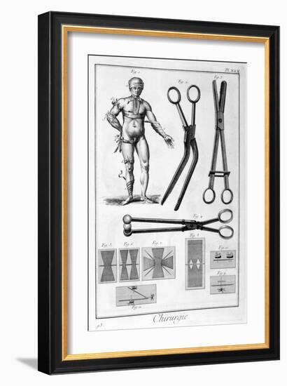 Surgery, 1751-1777-Denis Diderot-Framed Giclee Print