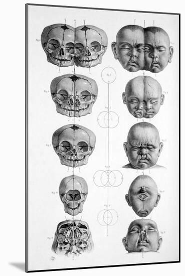 Surgical Anatomy, 1856-Science Source-Mounted Giclee Print