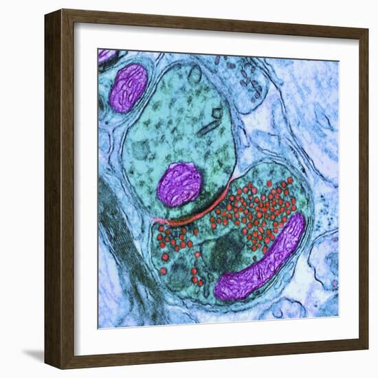 Synapse Nerve Junction, TEM-Thomas Deerinck-Framed Premium Photographic Print