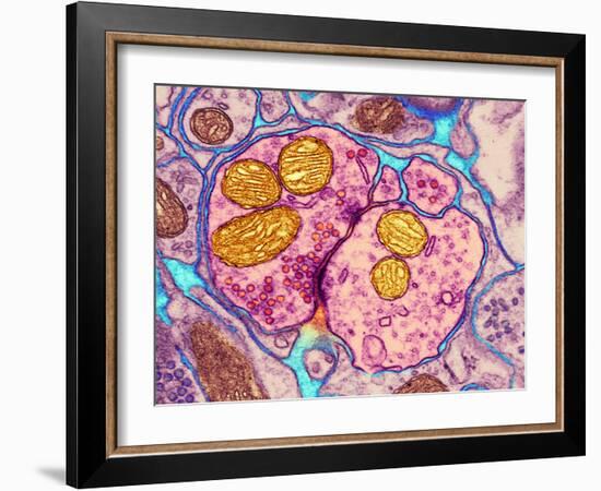 Synapse Nerve Junction, TEM-Thomas Deerinck-Framed Photographic Print