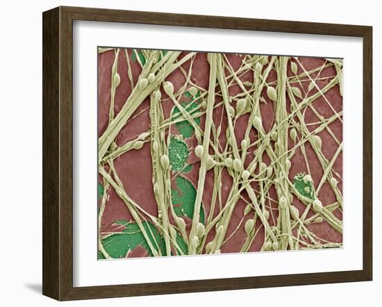 Synapse Nerve Junctions, SEM-Thomas Deerinck-Framed Photographic Print