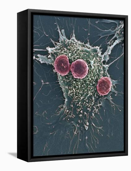 T Lymphocytes And Cancer Cell, SEM-Steve Gschmeissner-Framed Premier Image Canvas