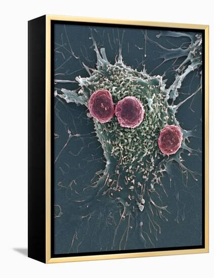 T Lymphocytes And Cancer Cell, SEM-Steve Gschmeissner-Framed Premier Image Canvas