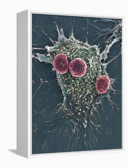 T Lymphocytes And Cancer Cell, SEM-Steve Gschmeissner-Framed Premier Image Canvas