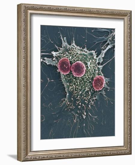 T Lymphocytes And Cancer Cell, SEM-Steve Gschmeissner-Framed Photographic Print