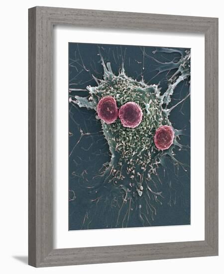 T Lymphocytes And Cancer Cell, SEM-Steve Gschmeissner-Framed Photographic Print