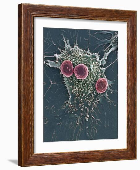 T Lymphocytes And Cancer Cell, SEM-Steve Gschmeissner-Framed Photographic Print