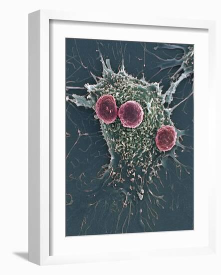 T Lymphocytes And Cancer Cell, SEM-Steve Gschmeissner-Framed Photographic Print