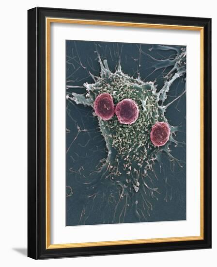 T Lymphocytes And Cancer Cell, SEM-Steve Gschmeissner-Framed Photographic Print