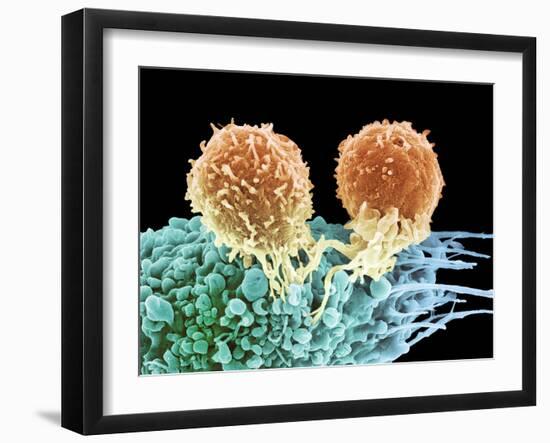 T Lymphocytes And Cancer Cell, SEM-Steve Gschmeissner-Framed Photographic Print