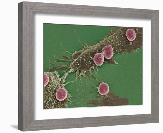 T Lymphocytes And Cancer Cells, SEM-Steve Gschmeissner-Framed Photographic Print