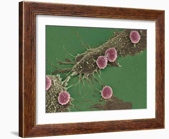 T Lymphocytes And Cancer Cells, SEM-Steve Gschmeissner-Framed Photographic Print