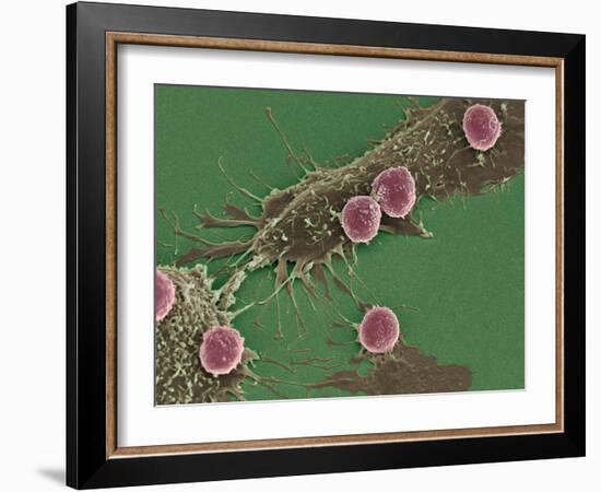 T Lymphocytes And Cancer Cells, SEM-Steve Gschmeissner-Framed Photographic Print