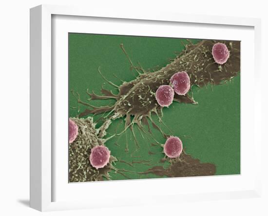 T Lymphocytes And Cancer Cells, SEM-Steve Gschmeissner-Framed Photographic Print