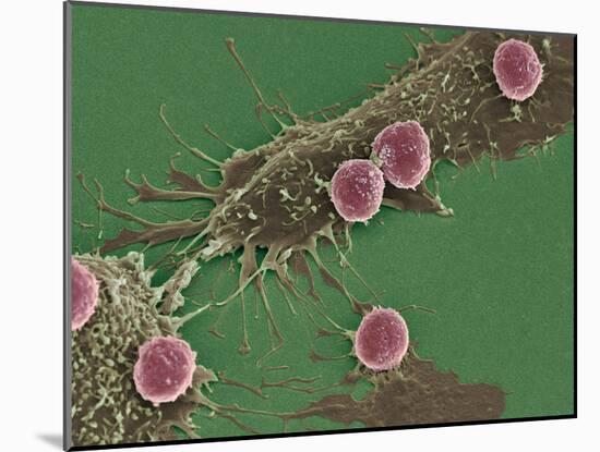 T Lymphocytes And Cancer Cells, SEM-Steve Gschmeissner-Mounted Photographic Print