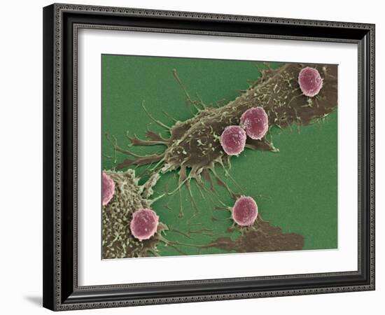 T Lymphocytes And Cancer Cells, SEM-Steve Gschmeissner-Framed Photographic Print