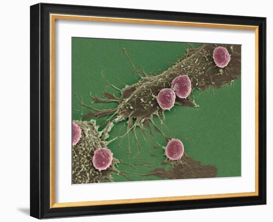 T Lymphocytes And Cancer Cells, SEM-Steve Gschmeissner-Framed Photographic Print