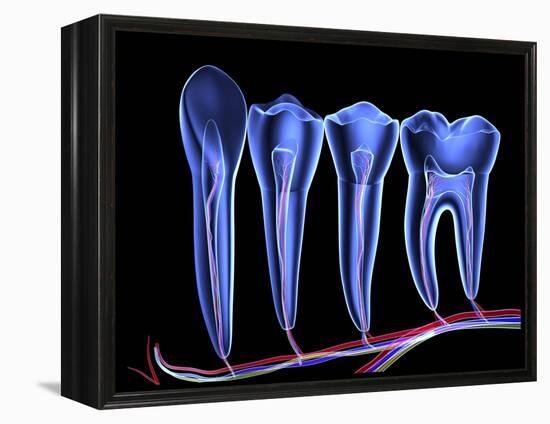 Teeth, Cross Section-PASIEKA-Framed Premier Image Canvas