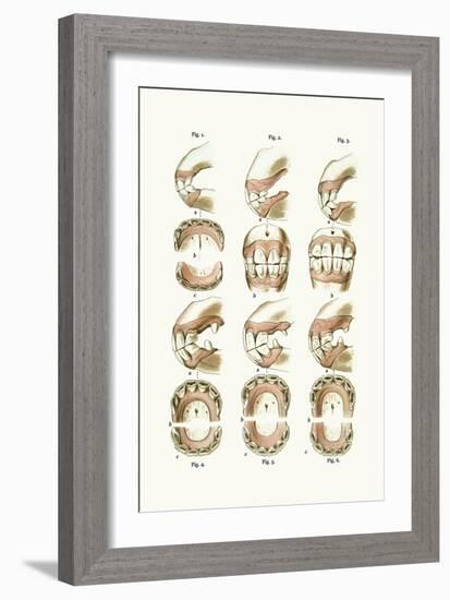 Teeth Plate Description-Samuel Sidney-Framed Art Print