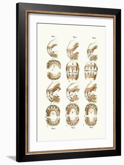 Teeth Plate Description-Samuel Sidney-Framed Art Print