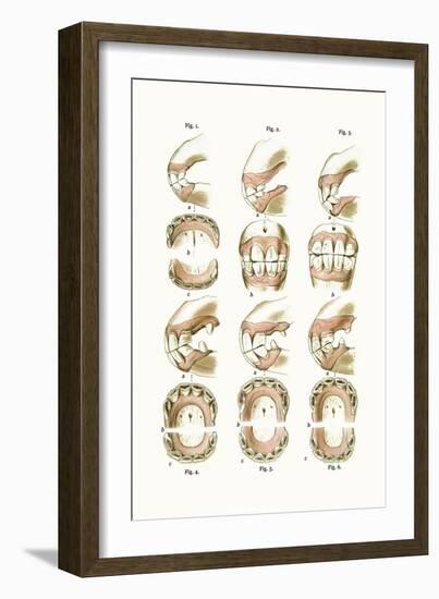 Teeth Plate Description-Samuel Sidney-Framed Art Print