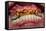 Teeth Showing Plaque-Science Photo Library-Framed Premier Image Canvas