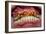 Teeth Showing Plaque-Science Photo Library-Framed Photographic Print