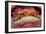 Teeth Showing Plaque-Science Photo Library-Framed Photographic Print