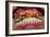 Teeth Showing Plaque-Science Photo Library-Framed Photographic Print
