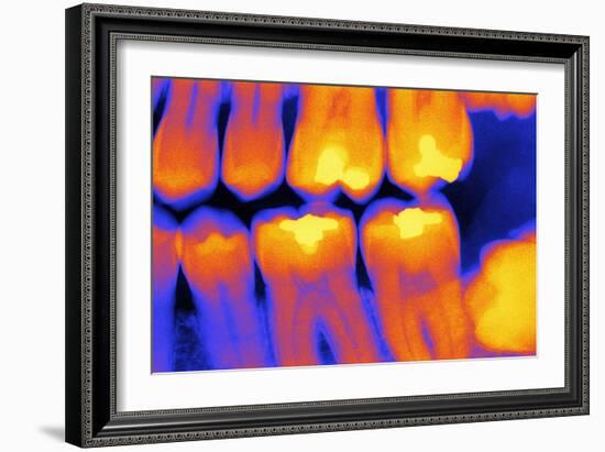 Teeth with Fillings, X-ray-PASIEKA-Framed Photographic Print