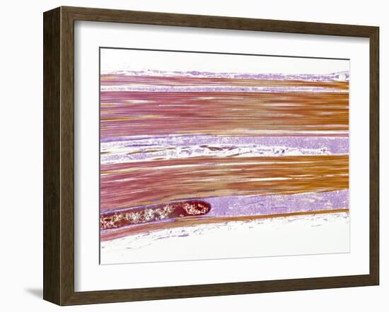 Tendon Fibres, TEM-Steve Gschmeissner-Framed Photographic Print