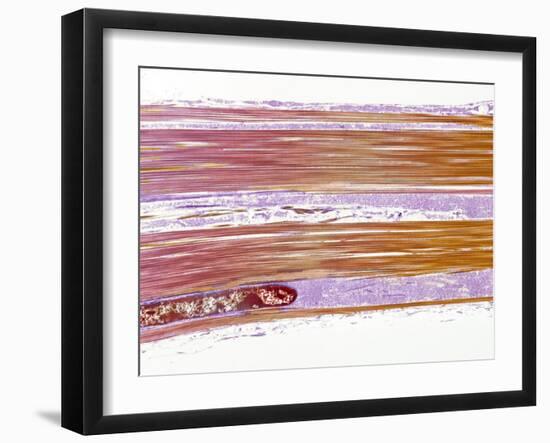 Tendon Fibres, TEM-Steve Gschmeissner-Framed Photographic Print