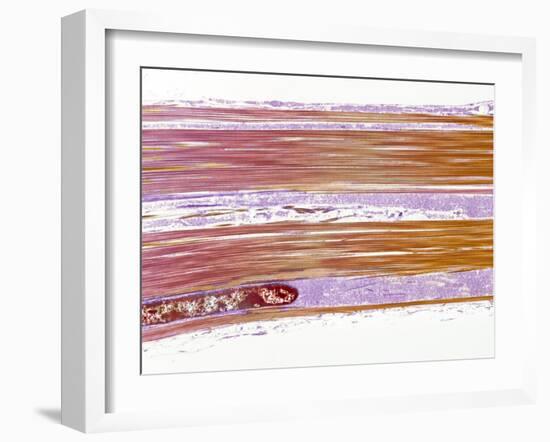 Tendon Fibres, TEM-Steve Gschmeissner-Framed Photographic Print