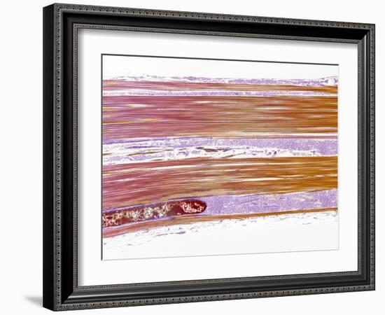 Tendon Fibres, TEM-Steve Gschmeissner-Framed Photographic Print