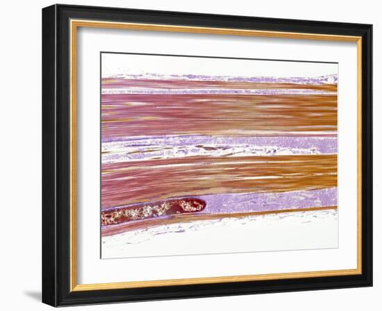 Tendon Fibres, TEM-Steve Gschmeissner-Framed Photographic Print