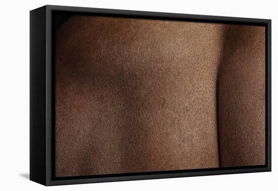 Texture of Human Skin. close up of African-American Male Body-master1305-Framed Premier Image Canvas