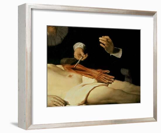 The Anatomy Lesson of Dr. Nicolaes Tulp, 1632-Rembrandt van Rijn-Framed Giclee Print