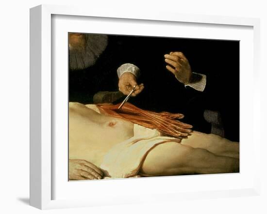 The Anatomy Lesson of Dr. Nicolaes Tulp, 1632-Rembrandt van Rijn-Framed Giclee Print