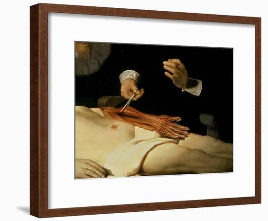 The Anatomy Lesson of Dr. Nicolaes Tulp, 1632-Rembrandt van Rijn-Framed Giclee Print