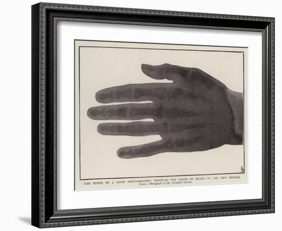 The Bones of a Hand Photographed Through the Flesh by Means of the New Process-null-Framed Giclee Print